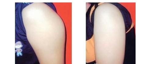 上海九院的整形價(jià)格表是怎樣的？它適合想要變美的人嗎？