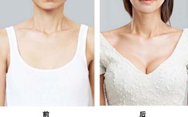 深圳非凡整形醫(yī)院真的正規(guī)可靠嗎？整形手術價格貴不貴，醫(yī)生怎么樣，口碑評價怎么樣？