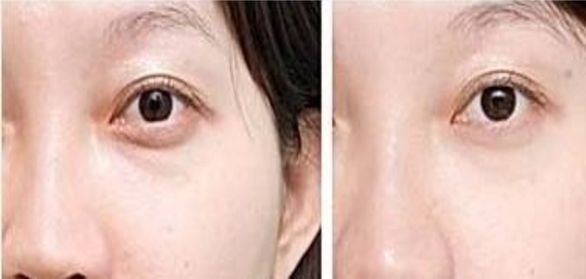上海排名靠前的整形醫(yī)院推薦，想知道哪家好？最受歡迎的三甲醫(yī)療機(jī)構(gòu)名單已公布！