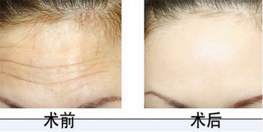 排行榜前十！沈陽植發(fā)醫(yī)院技術高超有口碑