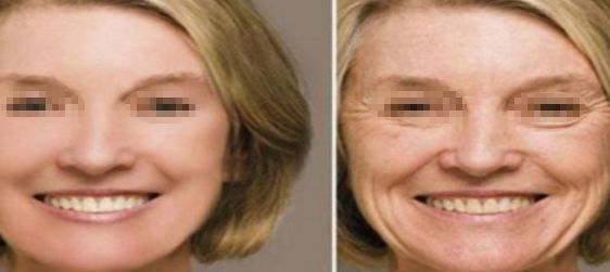 大連許英醫(yī)療美容如何？找到適合你的完美美容之處
