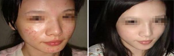 成都整形美容醫(yī)院排名揭曉，領(lǐng)先競爭對手遠遠搶先！