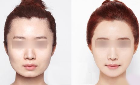昆明哪里有最好的眼部手術(shù)整形醫(yī)院？2024年10家排名搶先曝光！