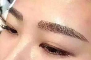 絕佳效果！體驗成都周維開刀雙眼皮的精彩案例