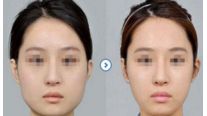 【2024】杭州十大值得信賴的整形美容醫(yī)院推薦！