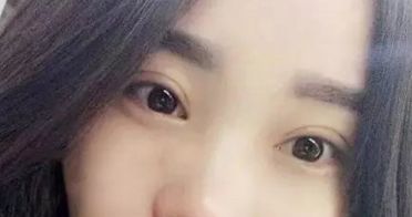 杭州最受贊譽(yù)的整容醫(yī)院整形手術(shù)效果揭秘 杭州最受贊譽(yù)的整容醫(yī)院整形手術(shù)效果揭秘
