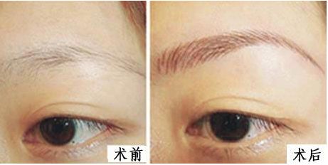 上海九院整形外科醫(yī)生排名新鮮發(fā)布！3位專家各具特長！