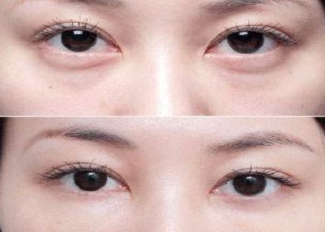 北京最受歡迎的整形醫(yī)院排名高居前三！私立醫(yī)美實(shí)力超越公立醫(yī)院！