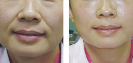哪位醫(yī)生是擅長進行顱頜面手術(shù)的專家？名單更新與價格參考