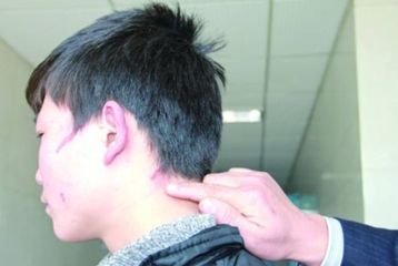 上海哪家醫(yī)院的紋身去除技術(shù)更專業(yè)，排名榜單推薦，實(shí)力強(qiáng)大！