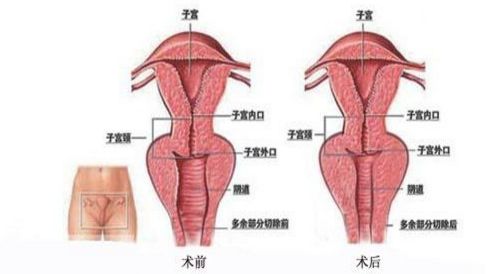 北京最佳乳房再造醫(yī)院排行榜，八強(qiáng)環(huán)境多元，知名醫(yī)生鼎力支持