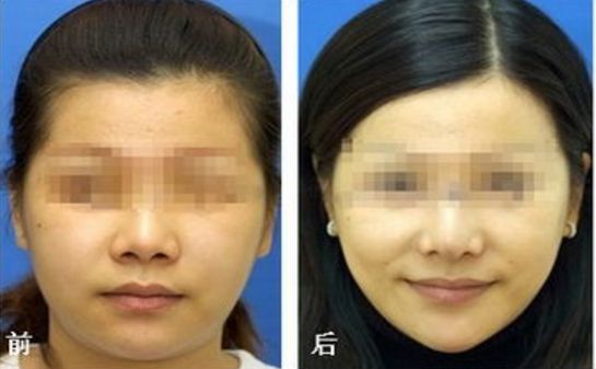 昆明乳房整形哪家醫(yī)院專業(yè)可信？榜單前五推薦，選你中意的