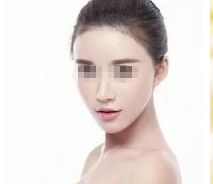 深圳哪家醫(yī)院能安全有效地進(jìn)行隆鼻整形？