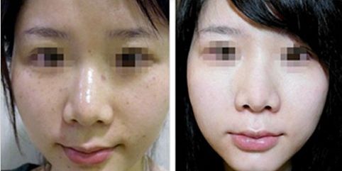 合肥哪幾家三甲整形醫(yī)院受歡迎？