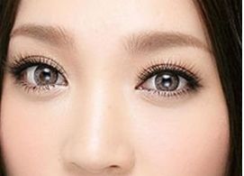 2023年，出色表現(xiàn)的國外進口玻尿酸排行榜前十品牌揭曉！