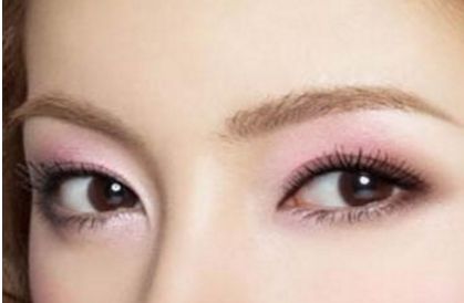 北京協(xié)和醫(yī)院白明醫(yī)生的雙眼皮手術(shù)效果如何？真實(shí)案例展示給你看
