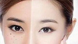 獨家揭秘！了解重慶楊武林醫(yī)生的墊下巴整形全過程