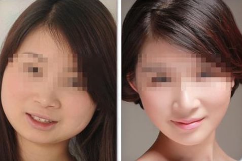 國內(nèi)備受矚目的小拉皮手術頂級專家一覽 國內(nèi)備受矚目的小拉皮手術頂級專家一覽