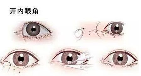 廣州畸形耳朵手術(shù)？值得收藏的醫(yī)院推薦！