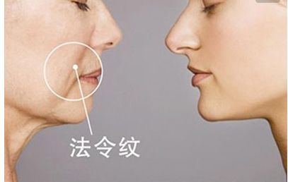 長(zhǎng)沙田毅雙眼皮手術(shù)新穎獨(dú)特，引領(lǐng)2023最新潮流