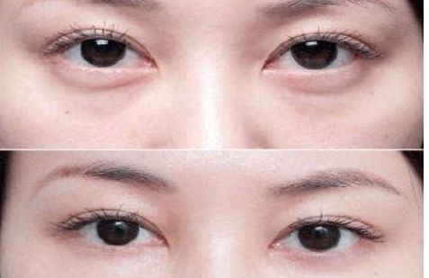 沈陽哪個(gè)醫(yī)院的整形專家口碑好，醫(yī)術(shù)高超的醫(yī)生推薦