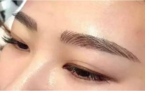 何晉龍磨骨成功，面容煥然一新！讓人難以置信的手術(shù)效果！