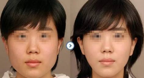昆明頂尖眼部醫(yī)生一覽:驚人實(shí)力的前五位專(zhuān)家名單曝光 昆明頂尖眼部醫(yī)生一覽:驚人實(shí)力的前五位專(zhuān)家名單曝光
