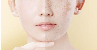 重慶新銅雀臺(tái)整形美容醫(yī)院褚健醫(yī)生的面部填充技術(shù)及真實(shí)案例分享 重慶新銅雀臺(tái)整形美容醫(yī)院褚健醫(yī)生的面部填充技術(shù)及真實(shí)案例分享