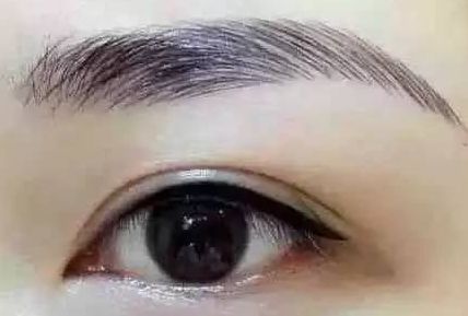 各路醫(yī)生實(shí)力大比拼！同帥與楊亞益，誰在雙眼皮手術(shù)上更出彩？