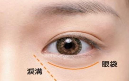 寧波最佳假體隆鼻醫(yī)院推薦及患者口碑排行榜單 寧波最佳假體隆鼻醫(yī)院推薦及患者口碑排行榜單