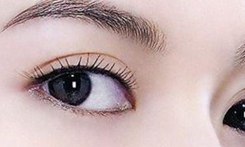 太玲美眸重現(xiàn)！揭秘雙眼皮新趨勢，驚艷效果讓人眼前一亮