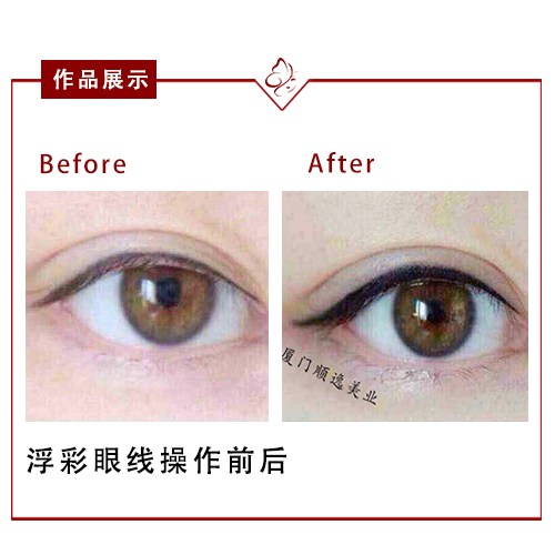 華美整形醫(yī)院在廣州口碑如何？高順福、袁耀東醫(yī)生值得信賴嗎？