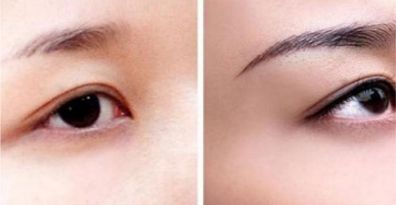 重慶頂尖眼部整形醫(yī)生、醫(yī)院排行榜一覽