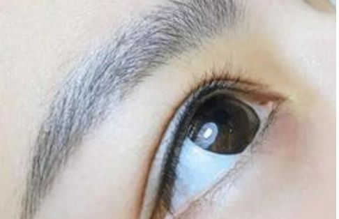 廣州名麗醫(yī)療美容醫(yī)院隆鼻案例分享：真實(shí)口碑大揭秘！