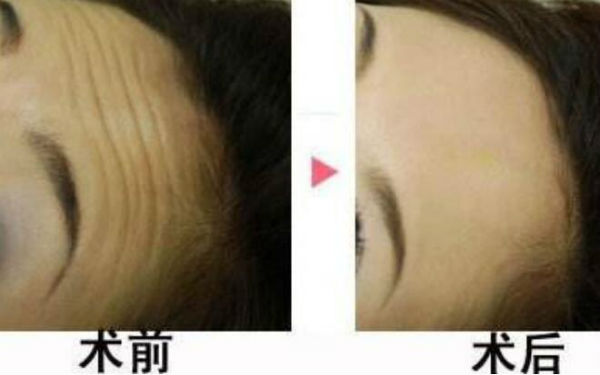 西安陽光整形醫(yī)院靠譜嗎？醫(yī)生背景和價格怎么樣？