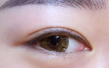 上海九院丨戴傳昌鼻子整形費用明細(xì)及專業(yè)技術(shù)解析 上海九院丨戴傳昌鼻子整形費用明細(xì)及專業(yè)技術(shù)解析