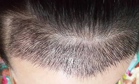看看這八家贛州整形醫(yī)院有沒有靠譜的？你知道嗎？