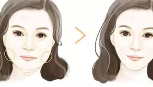 濟南整形美容醫(yī)院哪家好？諾德、藝星、韓氏躋身手術排行榜