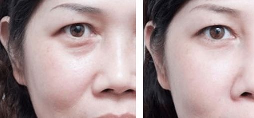 上海治療疤痕的醫(yī)院排名出爐！五家專業(yè)醫(yī)院實(shí)力震撼，趕快了解！