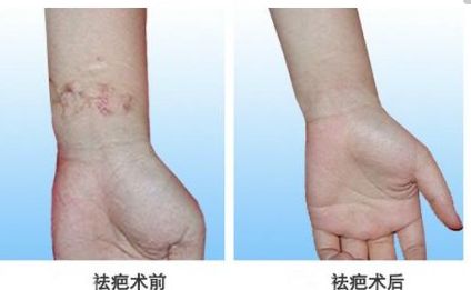 北京自體脂肪隆胸專家真實排行，專業(yè)技術(shù)精粹一同分享