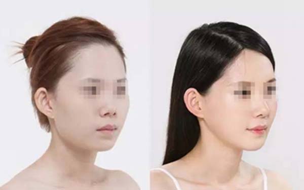 貴州六盤水吳氏嘉美整形醫(yī)院是口碑不錯嗎？如何一鍵獲取醫(yī)院口碑？