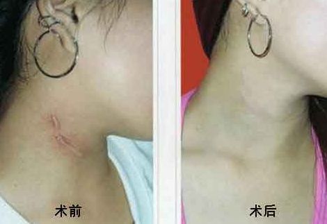 重慶乳房整形六大權(quán)威醫(yī)生盤點(diǎn)，高素質(zhì)專家排行曝光