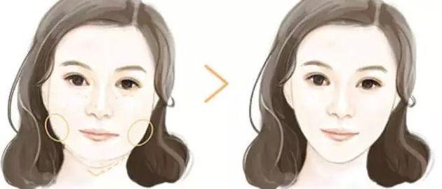 北京黎星醫(yī)生的面部脂肪填充效果如何？真實(shí)案例揭秘！