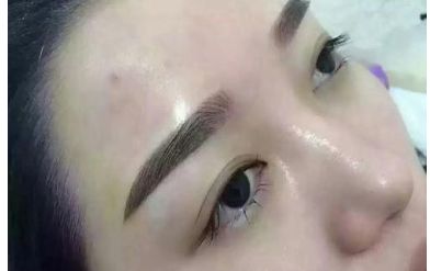 山西二院整形科的醫(yī)生名單更新及熱門項(xiàng)目價格表分享 山西二院整形科的醫(yī)生名單更新及熱門項(xiàng)目價格表分享