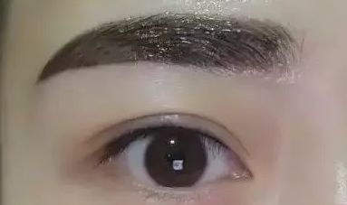 上海瑞格整形醫(yī)院領銜醫(yī)師羅瀾濤——重塑美麗眼睛的魔法使者，成功案例揭秘！