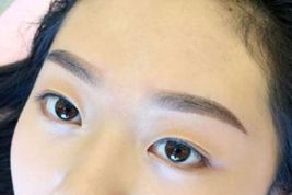 如何優(yōu)雅地擁有雙眼皮？了解專家經(jīng)驗與最新案例！