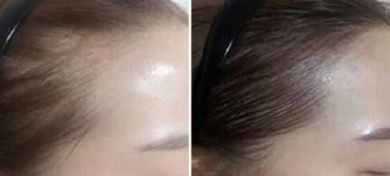 鄭州芳藝醫(yī)療整形醫(yī)院有沒有特色項(xiàng)目？如何一鍵獲?。? style=