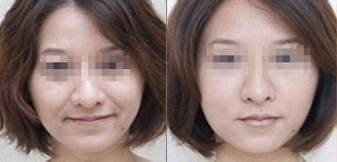 成都有哪些專業(yè)的雙眼皮整形醫(yī)生值得推薦？