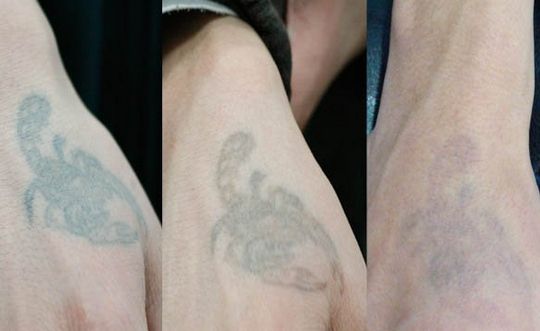 長沙哪家整形醫(yī)院技術(shù)靠譜？私立醫(yī)美還可信嗎？