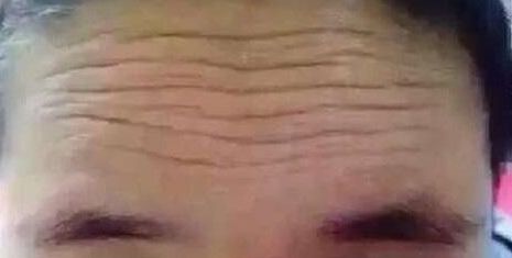福州鼻部整形醫(yī)院排行榜：絕對讓你滿意的前十所醫(yī)院，信賴放心！